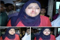“ভোট দিতে হবে না, চলে যান” – নারীদের পিটিয়ে রক্তাত্ত করলো সরকারী দল