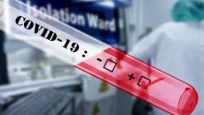 লস এঞ্জেলেসের হাসপাতালগুলোতে কমেছে করোনা আক্রান্ত রোগী