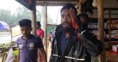রোহিঙ্গা ক্যাম্পে কয়েক দফায় সংঘর্ষ