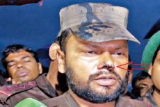 বিজিবি'র নায়েক রাজ্জাকের নাকে 