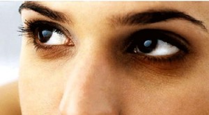 চোখের নিচের কালো দাগ সহজে দূর করার উপায়