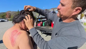 ক্যালিফোর্নিয়ায় কাজের জায়গায় ল্যান্ডস্কেপার দম্পতিকে নির্মমভাবে মারধর, সরঞ্জাম লুট