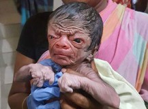 মাগুরায় অদ্ভুত শিশুর জন্ম
